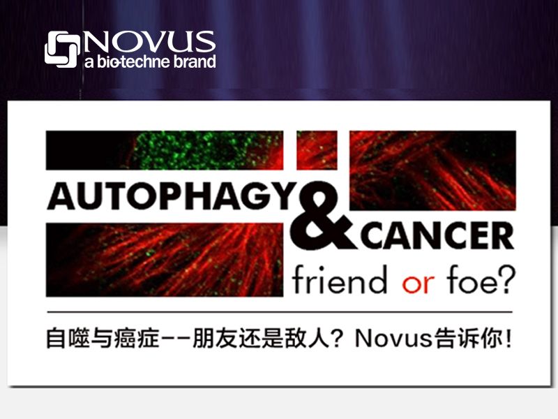 Read more about the article 自噬与癌症是朋友还是敌人？Novus告诉你！